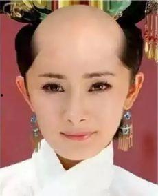 明星掉发吗,揭秘娱乐圈脱发现象