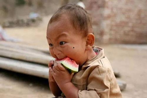 萌儿拔牙吃瓜,甜蜜瓜果助力勇敢微笑